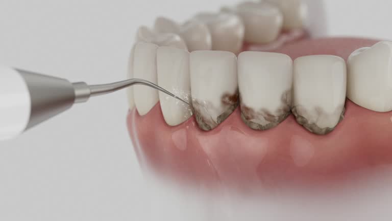 Trusted Teeth Cleaning And Checkup service in East Highland Park, VA - Dentist Open Now